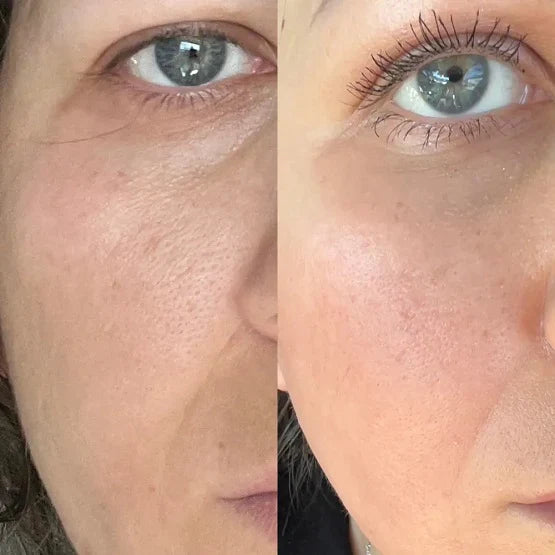 Medicube Zero Pore Cream 2.0 - 50ML