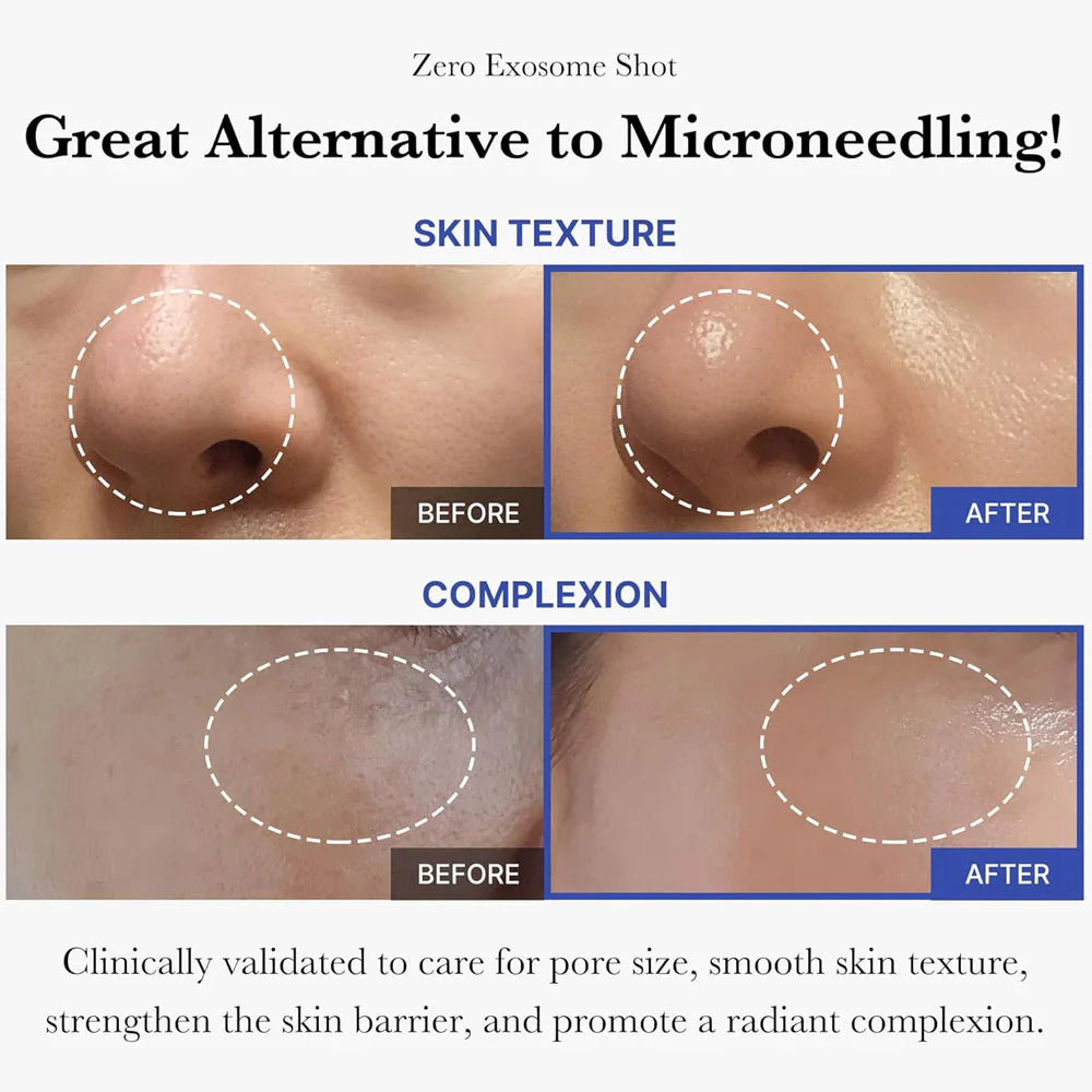 Medicube One Day Exosome Shot Pore Ampoule 7500 30ml